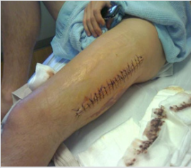 biomedres-openaccess-journal-bjstr