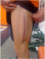 biomedres-openaccess-journal-bjstr