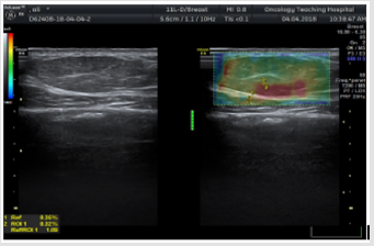 biomedres-openaccess-journal-bjstr