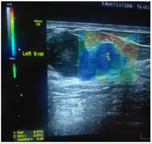 biomedres-openaccess-journal-bjstr