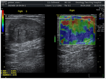 biomedres-openaccess-journal-bjstr