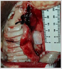 biomedres-openaccess-journal-bjstr