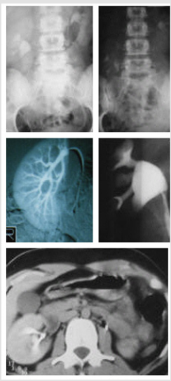 biomedres-openaccess-journal-bjstr