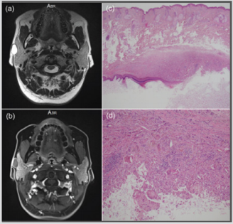 biomedres-openaccess-journal-bjstr