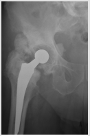 biomedres-openaccess-journal-bjstr