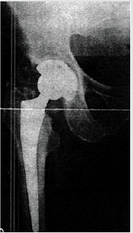 biomedres-openaccess-journal-bjstr
