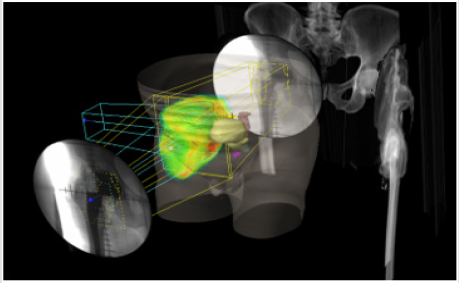 biomedres-openaccess-journal-bjstr