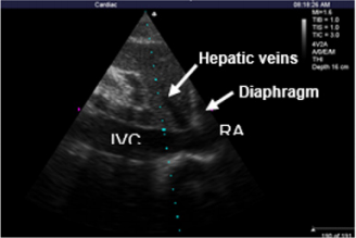 biomedres-openaccess-journal-bjstr