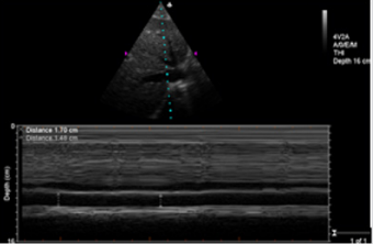 biomedres-openaccess-journal-bjstr