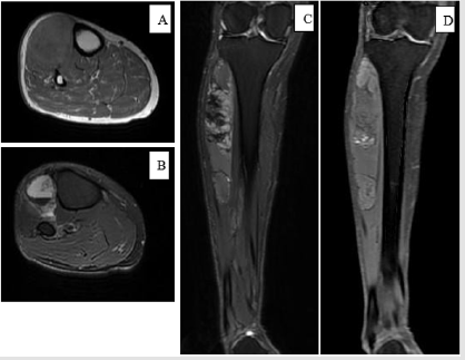 biomedres-openaccess-journal-bjstr