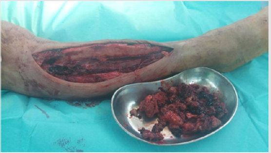 biomedres-openaccess-journal-bjstr