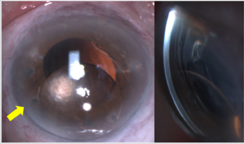 biomedres-openaccess-journal-bjstr