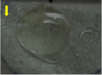 biomedres-openaccess-journal-bjstr