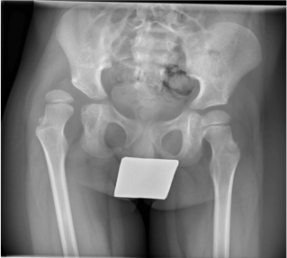 biomedres-openaccess-journal-bjstr