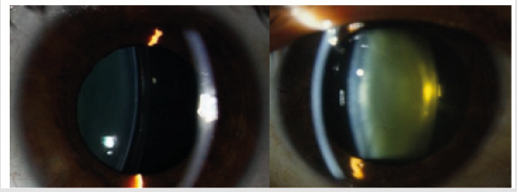 biomedres-openaccess-journal-bjstr