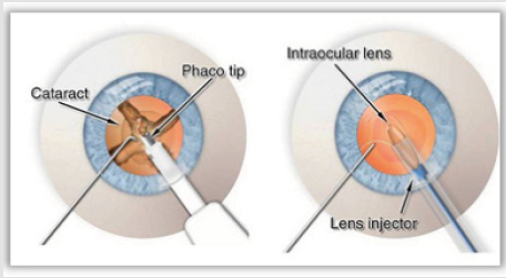 biomedres-openaccess-journal-bjstr