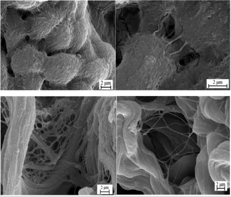 biomedres-openaccess-journal-bjstr