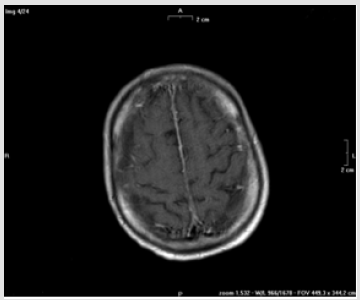 biomedres-openaccess-journal-bjstr