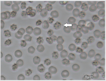 biomedres-openaccess-journal-bjstr