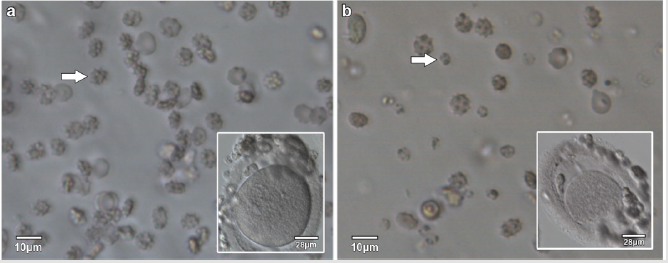 biomedres-openaccess-journal-bjstr
