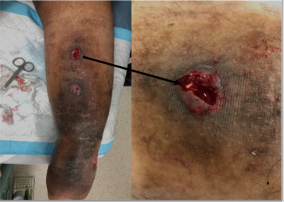 biomedres-openaccess-journal-bjstr