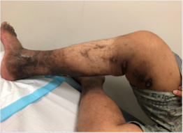 biomedres-openaccess-journal-bjstr