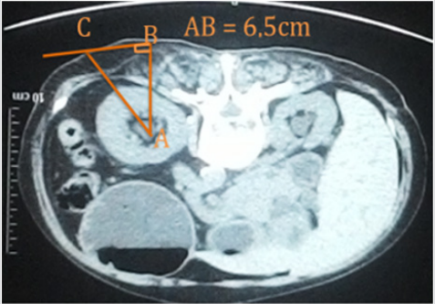 biomedres-openaccess-journal-bjstr