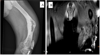 biomedres-openaccess-journal-bjstr