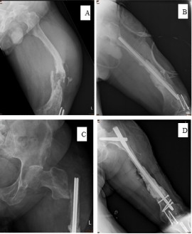 biomedres-openaccess-journal-bjstr