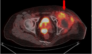 biomedres-openaccess-journal-bjstr