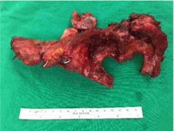 biomedres-openaccess-journal-bjstr