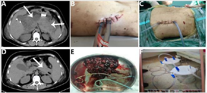 biomedres-openaccess-journal-bjstr