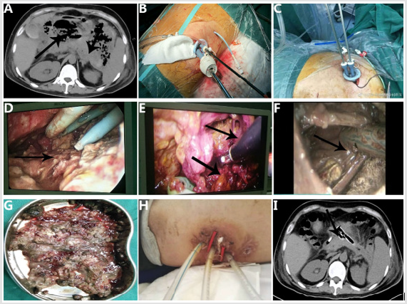 biomedres-openaccess-journal-bjstr
