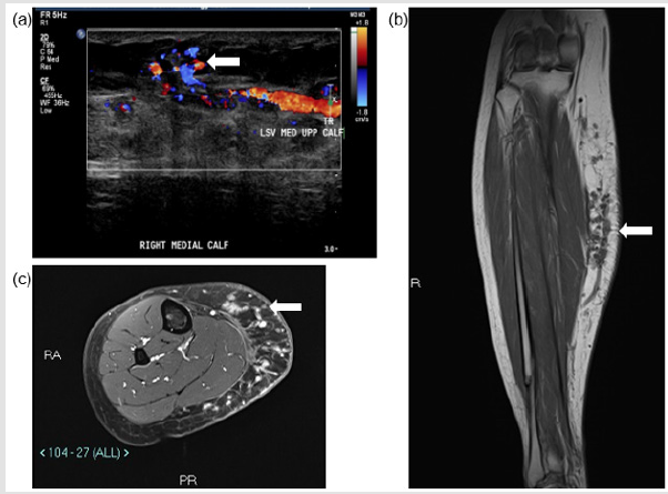 biomedres-openaccess-journal-bjstr