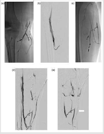 biomedres-openaccess-journal-bjstr