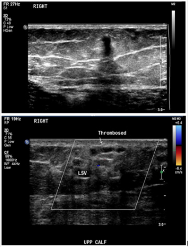 biomedres-openaccess-journal-bjstr