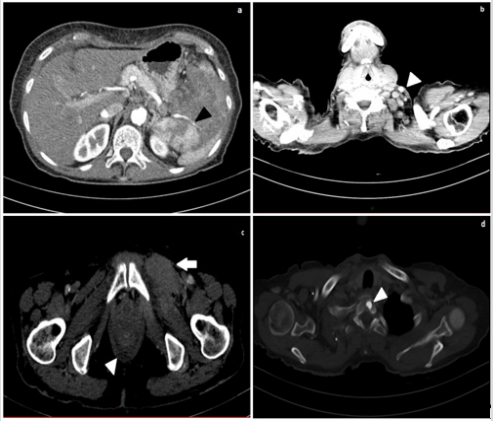 biomedres-openaccess-journal-bjstr