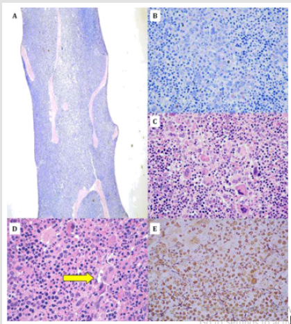 biomedres-openaccess-journal-bjstr