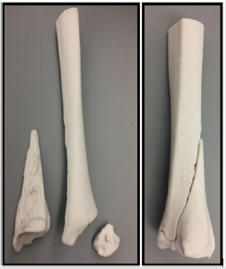 biomedres-openaccess-journal-bjstr