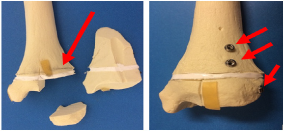 biomedres-openaccess-journal-bjstr
