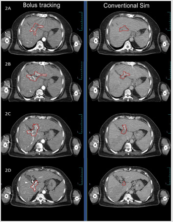 biomedres-openaccess-journal-bjstr