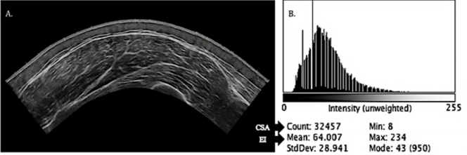 biomedres-openaccess-journal-bjstr