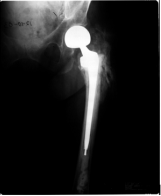 biomedres-openaccess-journal-bjstr