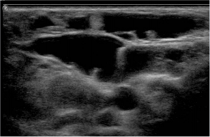 biomedres-openaccess-journal-bjstr