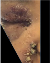 biomedres-openaccess-journal-bjstr