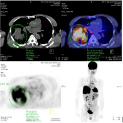 biomedres-openaccess-journal-bjstr