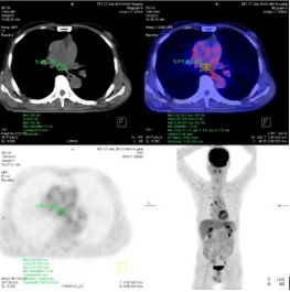 biomedres-openaccess-journal-bjstr
