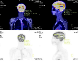 biomedres-openaccess-journal-bjstr