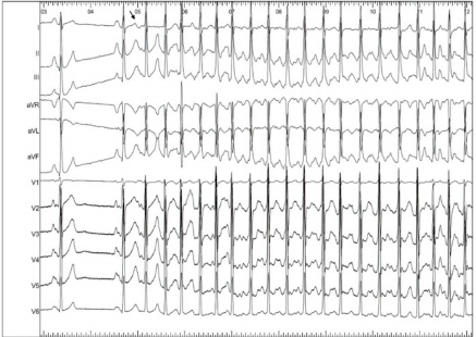 biomedres-openaccess-journal-bjstr