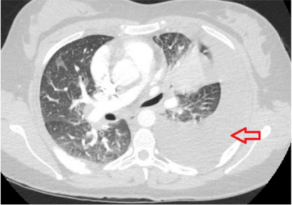 biomedres-openaccess-journal-bjstr